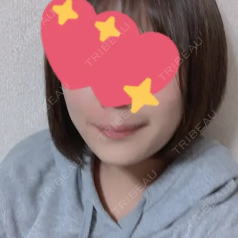 糸リフト / 脂肪吸引（顔） R Beauty CLINIC 銀座院 AFTER