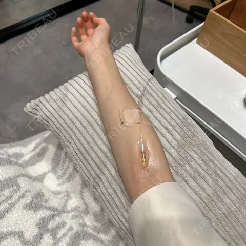 高濃度ビタミンC点滴 YAE C5 CLINIC AFTER
