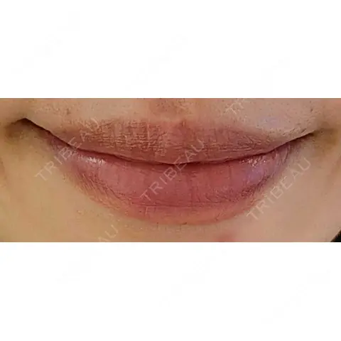 アートメイク（唇） にしまき美容スキンクリニック AFTER