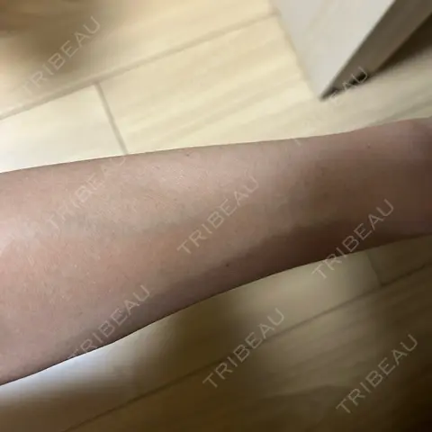 美容点滴・美容注射（美肌） / 白玉点滴・注射 東京銀座ウェルネス＆エイジングクリニック AFTER