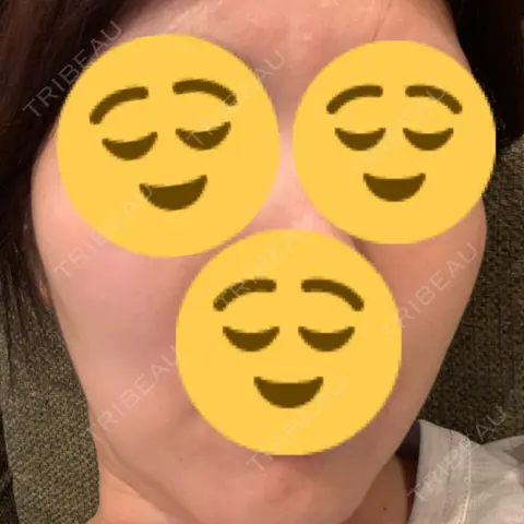 白玉点滴・注射 おおたかの森ビューティークリニック AFTER
