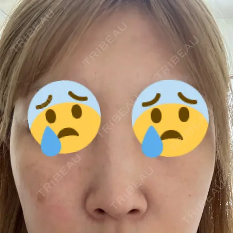 ルメッカ ルラ美容クリニック 大宮院 AFTER