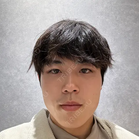 脂肪吸引注射（顔） ziz CLINIC AFTER