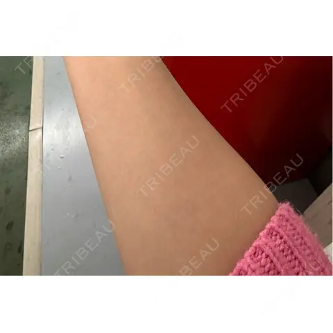 白玉点滴・注射 美容皮膚科エルムクリニック 麻布院 AFTER