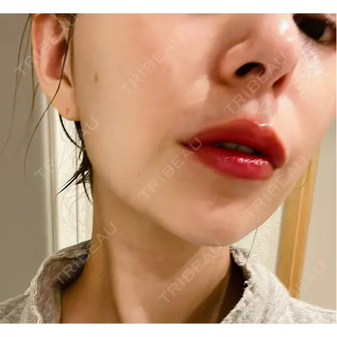 アートメイク（唇） ars clinic TOKYO / GINZAMaison AFTER