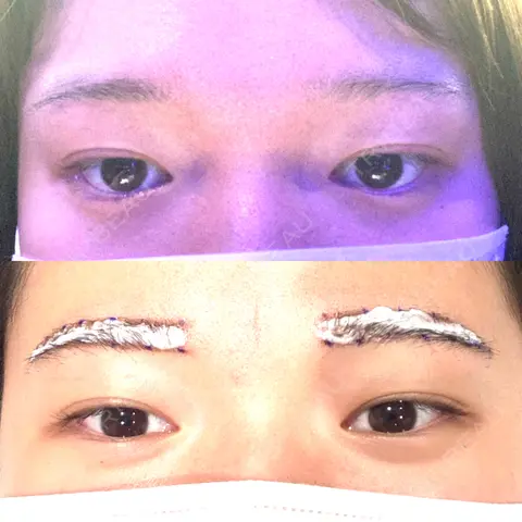 アートメイク（眉） Tokyo Tensei Clinic 新宿院 AFTER