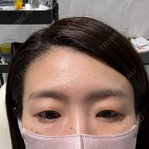 アートメイク（眉） Tokyo Tensei Clinic 新宿院 AFTER