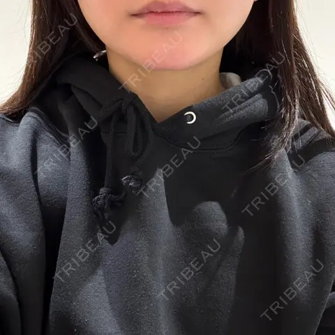 脂肪吸引（顔） / 脂肪吸引注射（顔） ziz CLINIC AFTER