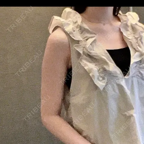 脂肪吸引（二の腕） / 豊胸（脂肪注入） / 脂肪吸引（肩） 藤・ナチュレ美容クリニック 銀座院 AFTER