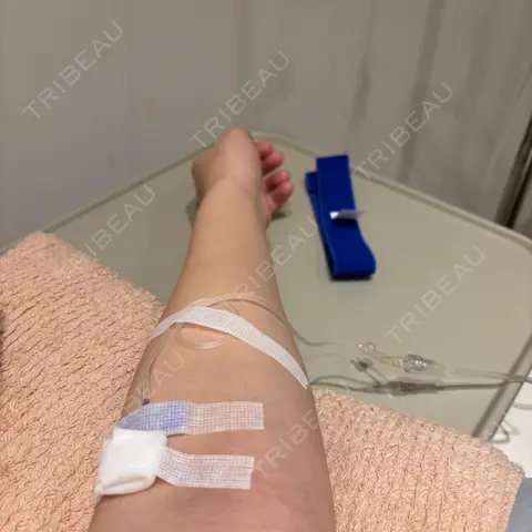 美容点滴・美容注射（美肌） ビー・ファインクリニック AFTER