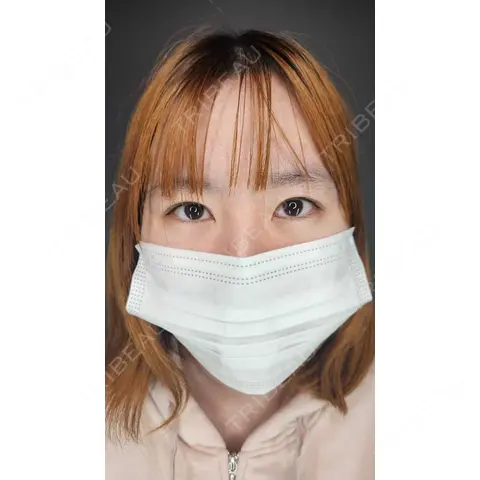 二重埋没 / 目頭切開 / 目尻切開 / タレ目形成・グラマラスライン（切開） Tokyo Tensei Clinic 新宿院 AFTER
