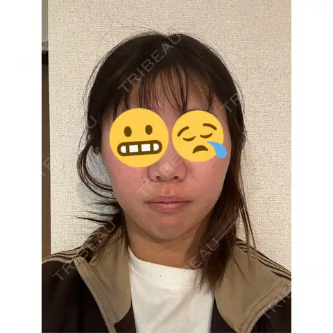 ポテンツァ NARU Beauty Clinic 【ナルクリ】 AFTER