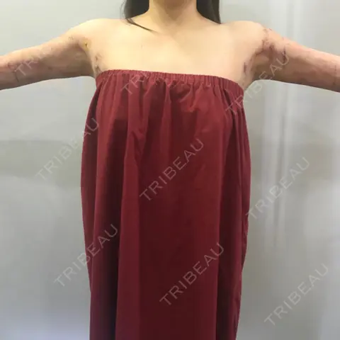 その他（目元） 狎鴎亭トップライン医院 AFTER