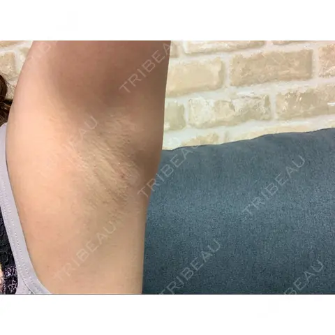 その他 しんはま耳鼻科・美容外科・形成外科・しんはま皮ふ科 AFTER