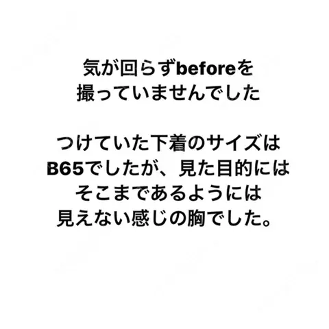 脂肪吸引（脚） / 豊胸（脂肪注入） Mods Clinic（モッズクリニック）東京院 BEFORE