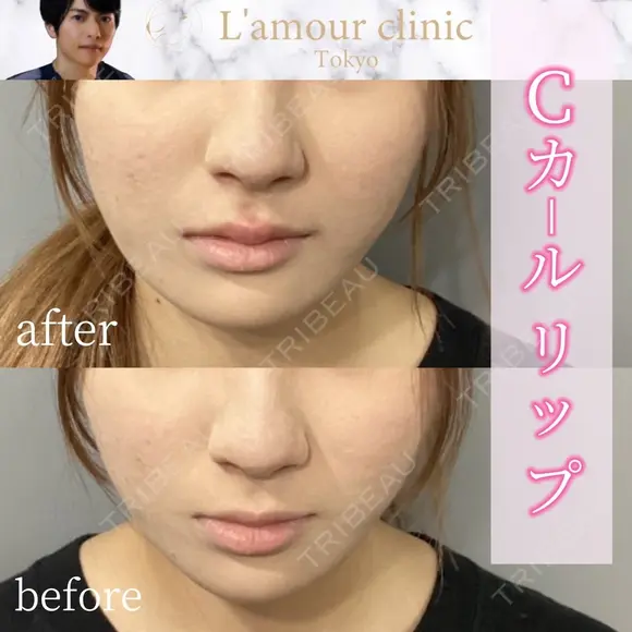 Cカールリップ after画像 メイン用