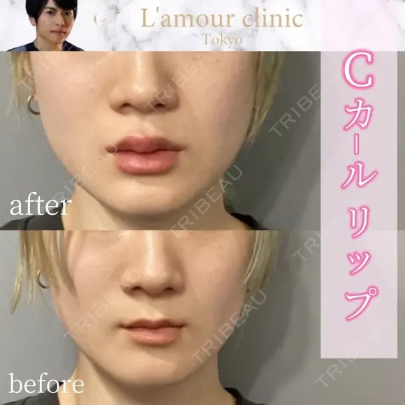 Cカールリップ after画像 メイン用