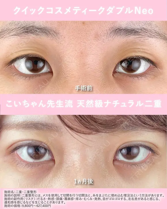クイックコスメティークダブル before画像 メイン用
