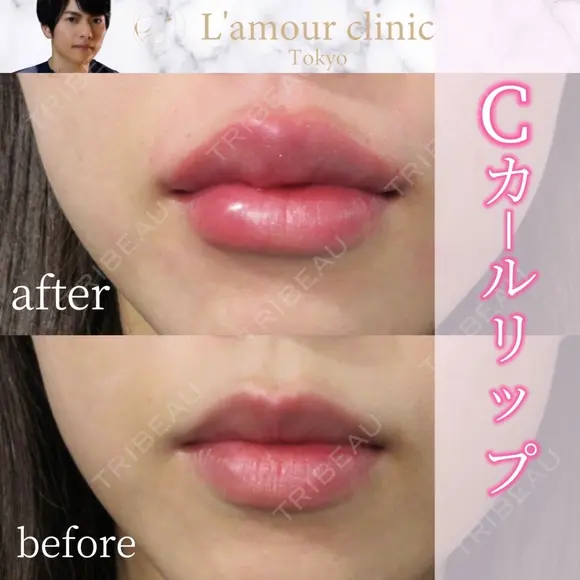 Cカールリップ after画像 メイン用