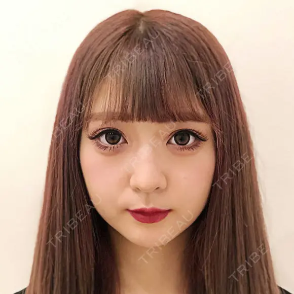 【メスを使わない小顔術】小顔Aスレッド® before画像 メイン用