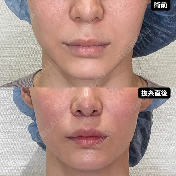人中短縮 after画像 メイン用