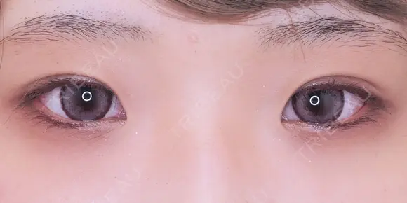 埋没法プレミアム after画像 メイン用