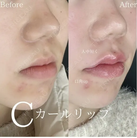 Cカールリップ after画像 メイン用