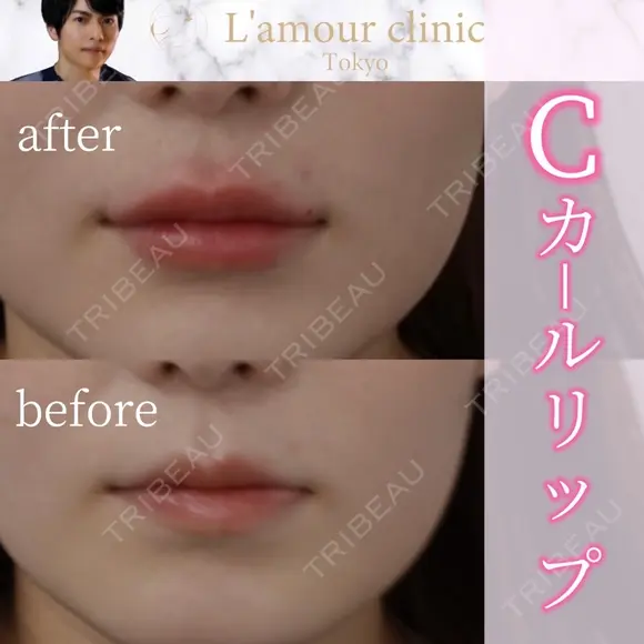 Cカールリップ after画像 メイン用