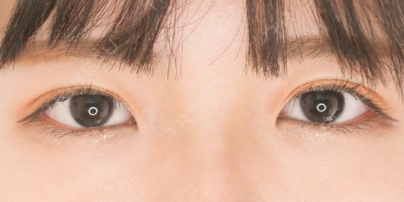 埋没法プレミアム after画像 メイン用