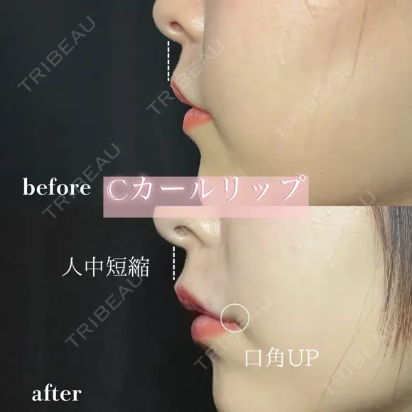 Cカールリップ after画像 メイン用
