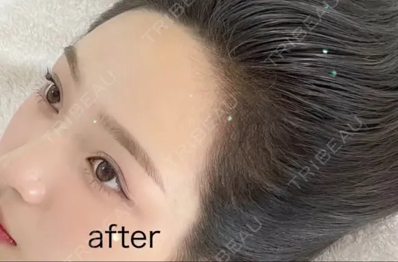 アートメイク　ヘアライン after画像 メイン用