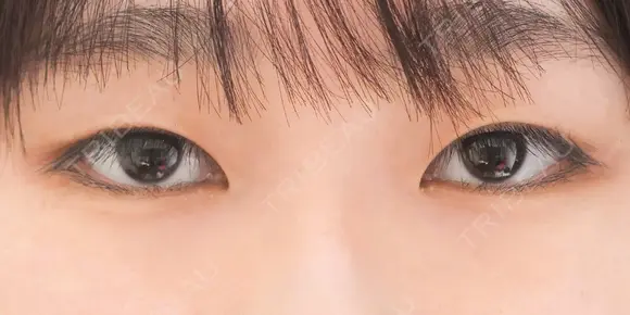 埋没法プレミアム before画像 メイン用