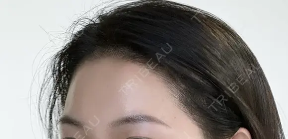 アートメイクヘアライン after画像 メイン用