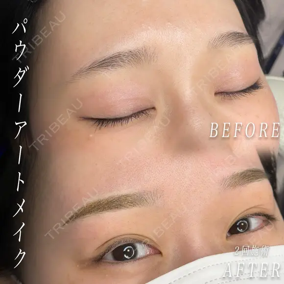アートメイク（眉） before画像 メイン用