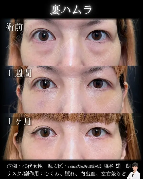 裏ハムラ before画像 メイン用