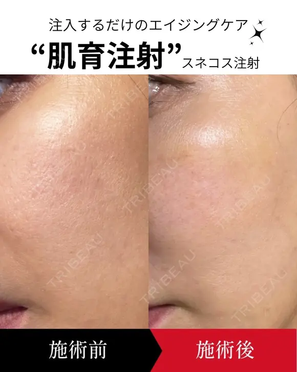 スネコスパフォルマ after画像 メイン用