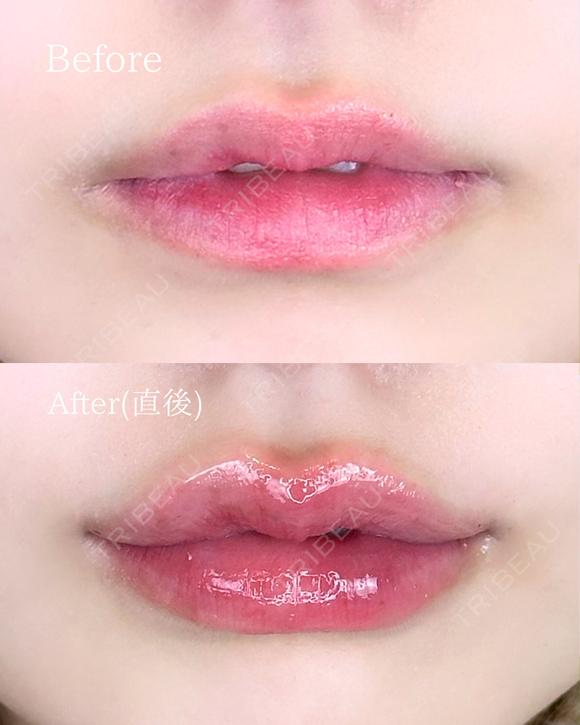 Cカールリップ♡ before画像 メイン用