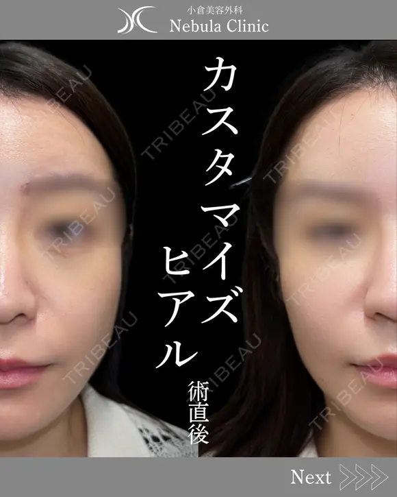Dr浦野執刀🪄カスタマイズヒアル before画像 メイン用