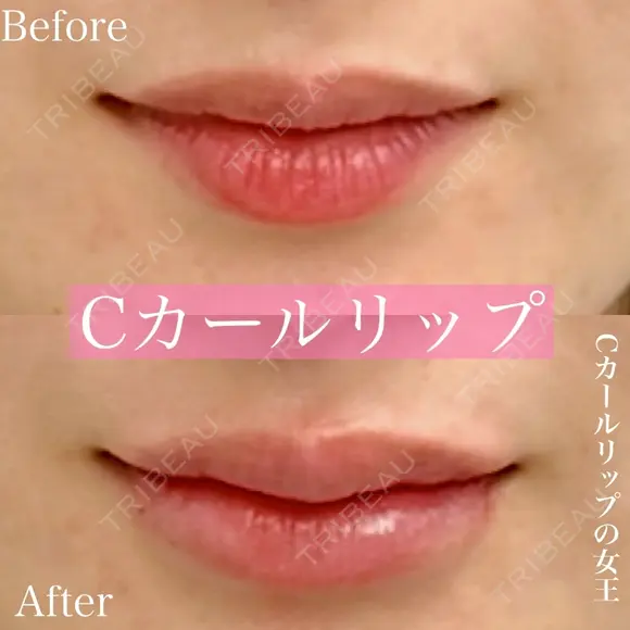 Cカールリップ before画像 メイン用