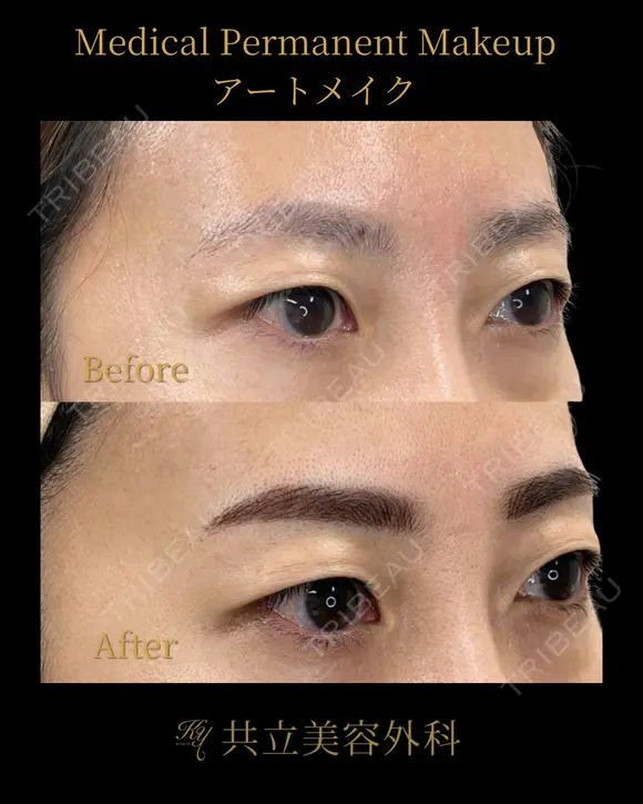 眉アートメイク before画像 メイン用