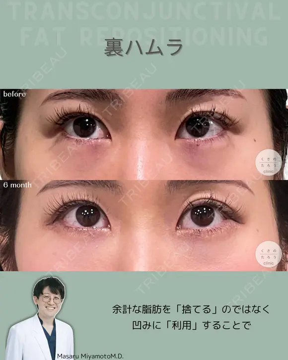 裏ハムラ after画像 メイン用