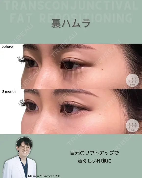 裏ハムラ after画像 メイン用