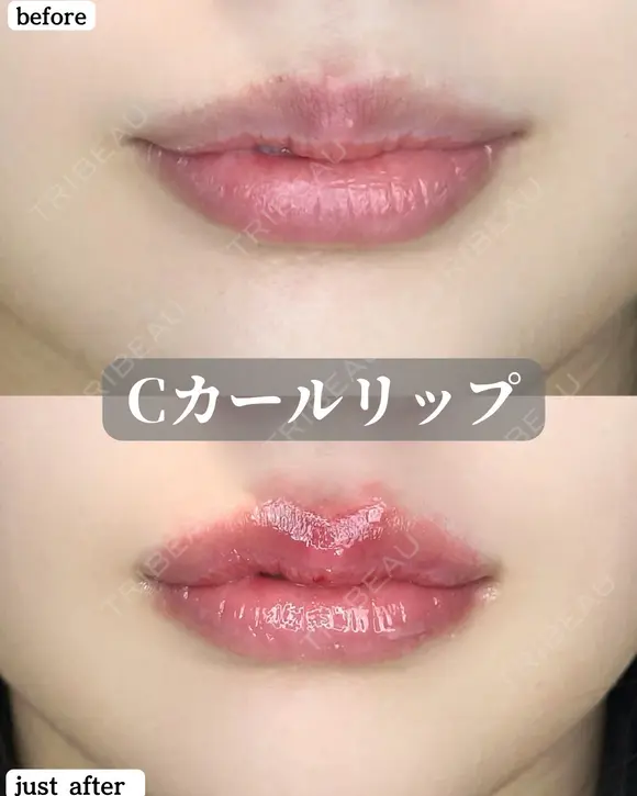 Cカールリップ before画像 メイン用