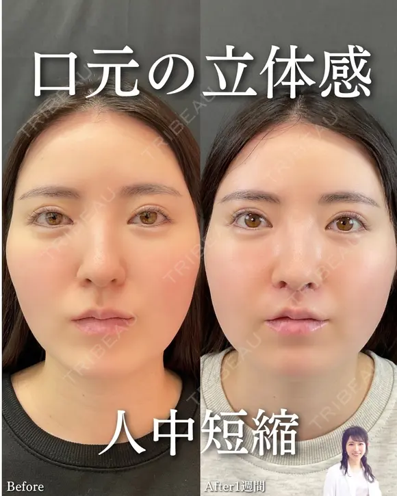 人中短縮 before画像 メイン用