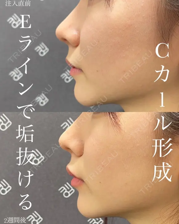 ✨なおき先生のcカール形成✨ 簡単垢抜けで大人気😍 before画像 メイン用