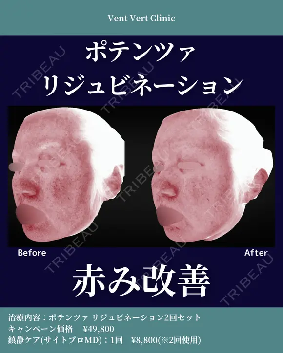 ポテンツァリジュビネーション before画像 メイン用
