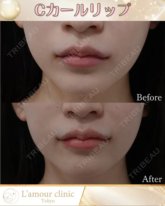 Cカールリップ after画像 メイン用