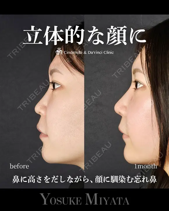 立体的な顔に before画像 メイン用