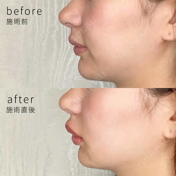 Cカールリップ💋✨ before画像 メイン用