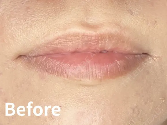 リップアートメイク before画像 メイン用